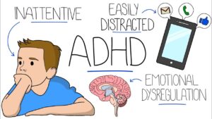 ADHD