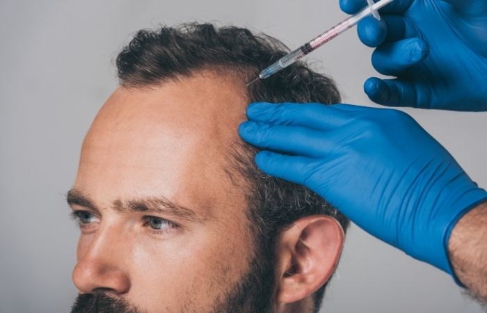 Hair Loss and Confidence: Breaking the Stigma