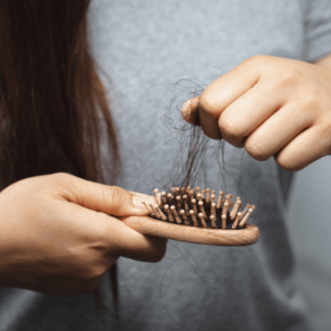 Hair Loss Treatment