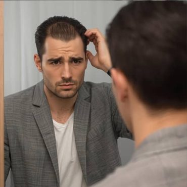 Online Hair Loss Treatment for Men in Ohio