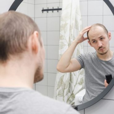 Online Hair Loss Treatment for Men in Indiana